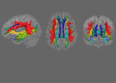 ���������: ��� ����� ����� � ��������, ������� ����������� �������